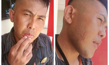 Jurnalis Kembali Jadi Korban Kekerasan Saat Meliput Dugaan Penggusuran Lahan