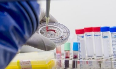 Harapan Baru! Peneliti UGM Berhasil Temukan Vaksin Flu Burung Varian Terbaru untuk Atasi Ancaman Superflu 2026