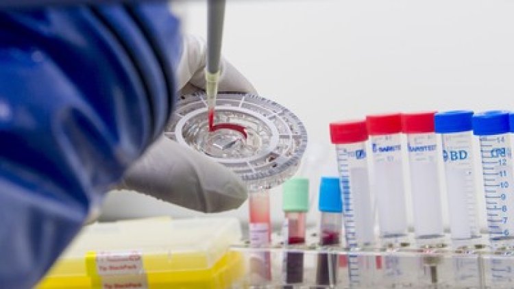 Harapan Baru! Peneliti UGM Berhasil Temukan Vaksin Flu Burung Varian Terbaru untuk Atasi Ancaman Superflu 2026