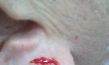 Tokoh Masyarakat Padang Nagoya Batam Prihatin atas Dugaan Pengeroyokan Lansia, Minta Penanganan Profesional dan Transparan