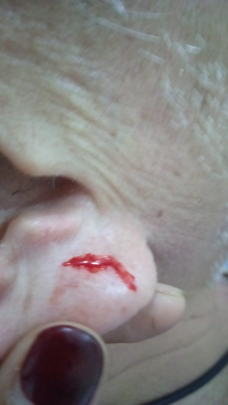 Tokoh Masyarakat Padang Nagoya Batam Prihatin atas Dugaan Pengeroyokan Lansia, Minta Penanganan Profesional dan Transparan